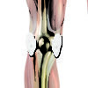 Pain-Free Pads - Image 4